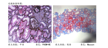 from clipboard from clipboard